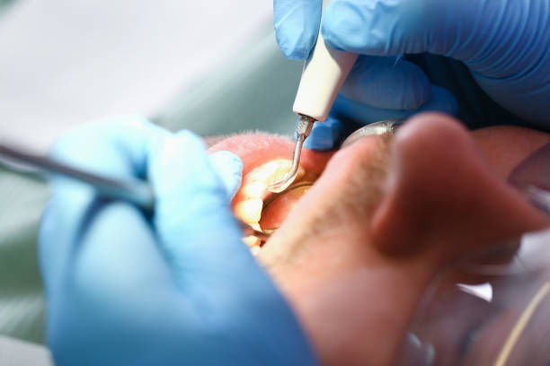 Best Broken Tooth Emergency  in Fritz Creek, AK